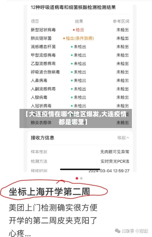 【大连疫情在哪个地区爆发,大连疫情都是哪里】-第1张图片
