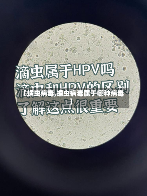 【蠕虫病毒,蠕虫病毒属于哪种病毒】-第1张图片