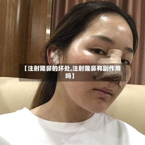 【注射隆鼻的坏处,注射隆鼻有副作用吗】-第1张图片