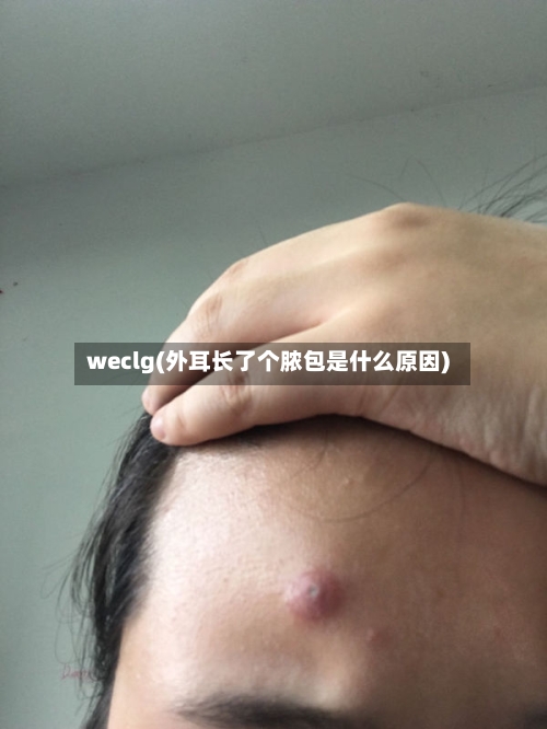 weclg(外耳长了个脓包是什么原因)-第1张图片